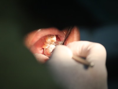 Стоматологічний огляд